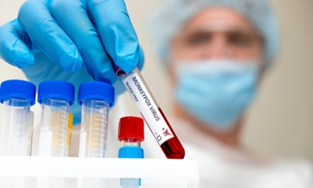 scientist holds vial with "monkeypox blood test"